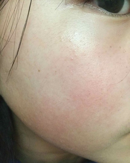 クリアターン ベイビッシュ ホワイトマスク/クリアターン/シートマスク・パックを使ったクチコミ(4枚目)