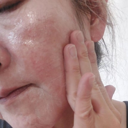 レッドブレミッシュ クリアスージングクリーム/Dr.G/フェイスクリームを使ったクチコミ(6枚目)