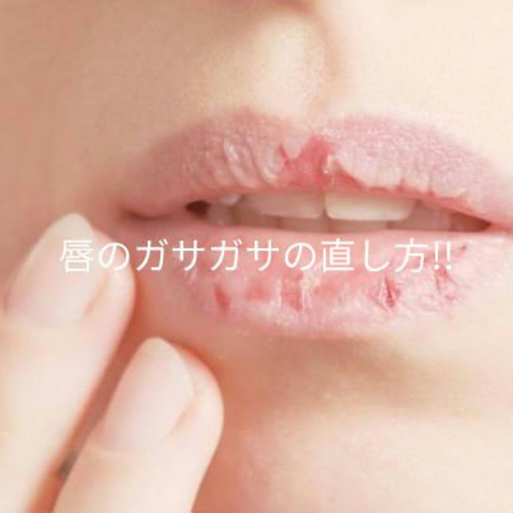 ニベア ディープモイスチャーリップ/ニベア/リップクリームを使ったクチコミ（1枚目）