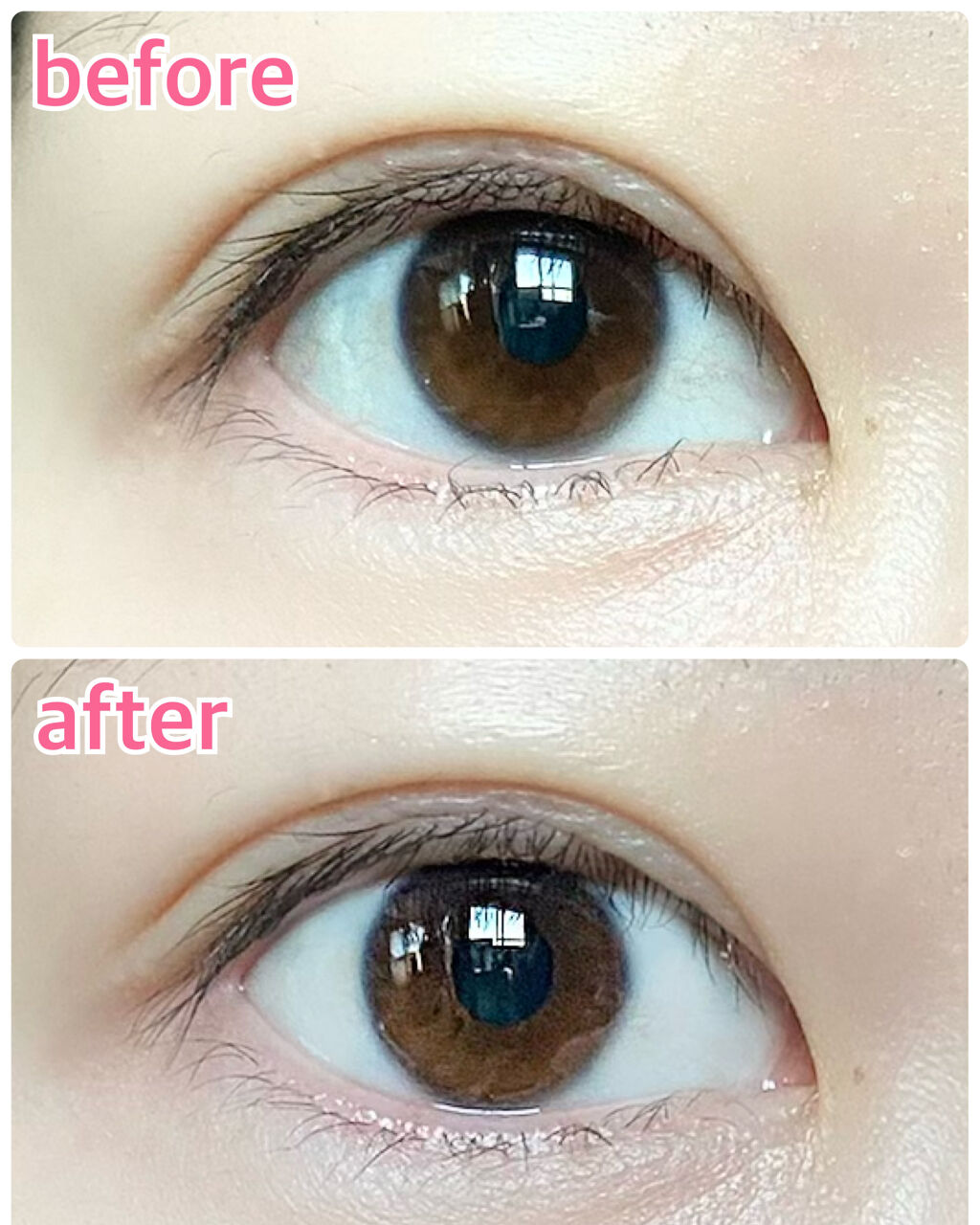 スマイルホワイティエ(医薬品)/ライオン/その他を使ったクチコミ（2枚目）