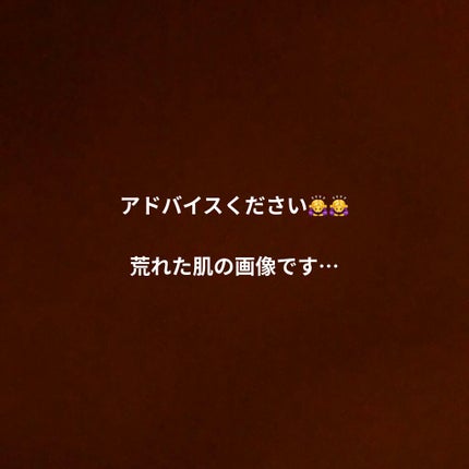 cocco on LIPS 「こんにちは!アドバイス頂きたくて投稿します。私の肌はおそらく、..」(1枚目)