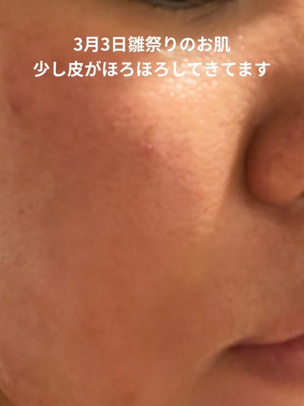 レチノールA 1% アドバンスドリバイタリゼーションクリーム/Life-flo/フェイスクリームを使ったクチコミ(5枚目)