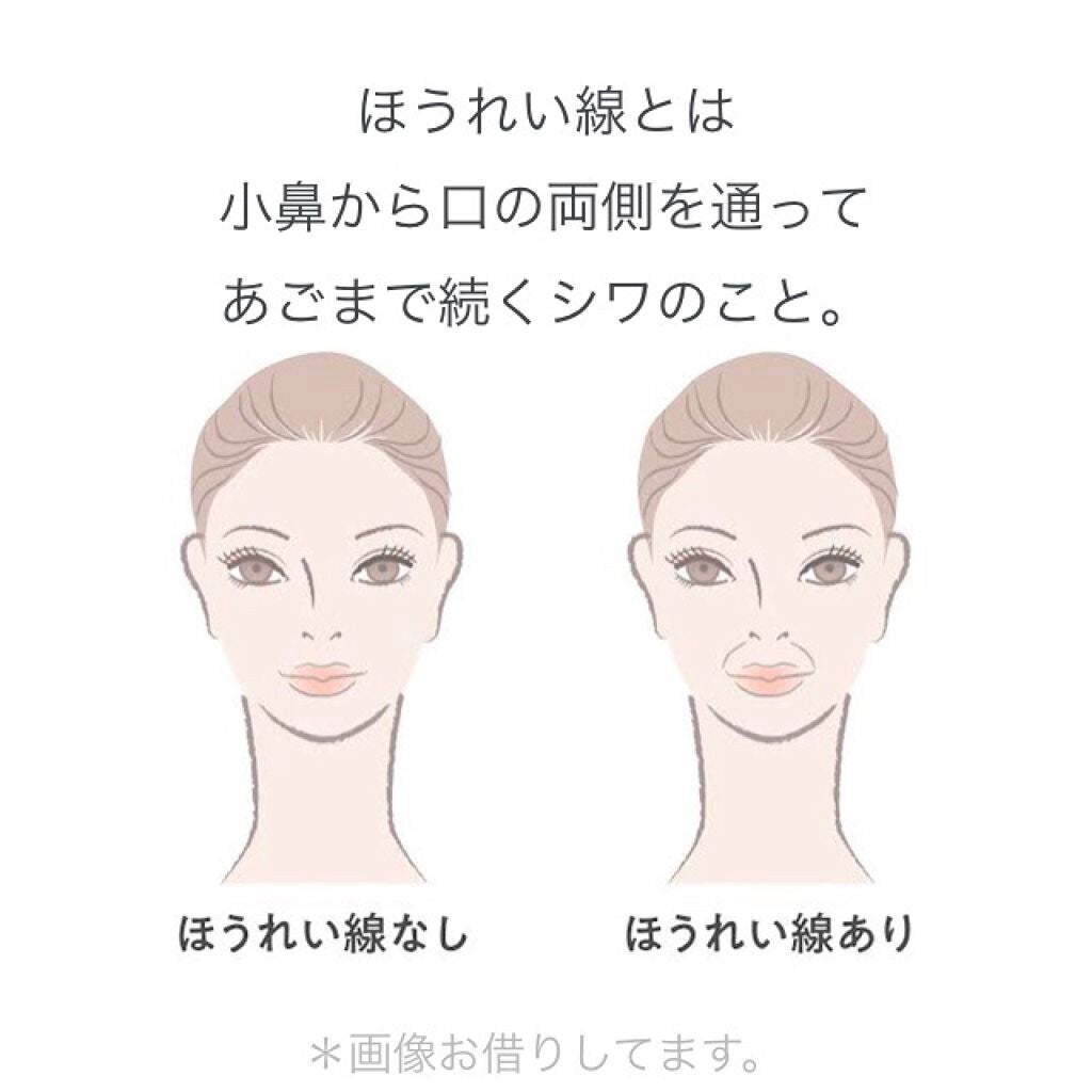 白ゆり@美容ブロガー on LIPS 「《ほうれい線ができる4つの原因と対処法》ほうれい線ってホ..」(2枚目)