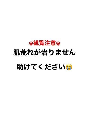 ミノン ミノン アミノモイスト モイストチャージ ミルクのクチコミ「助けてください😭
小学校5年生くらいからニキビがTゾーンに出来始め、高校生になった頃から頬や顎.....」（1枚目）