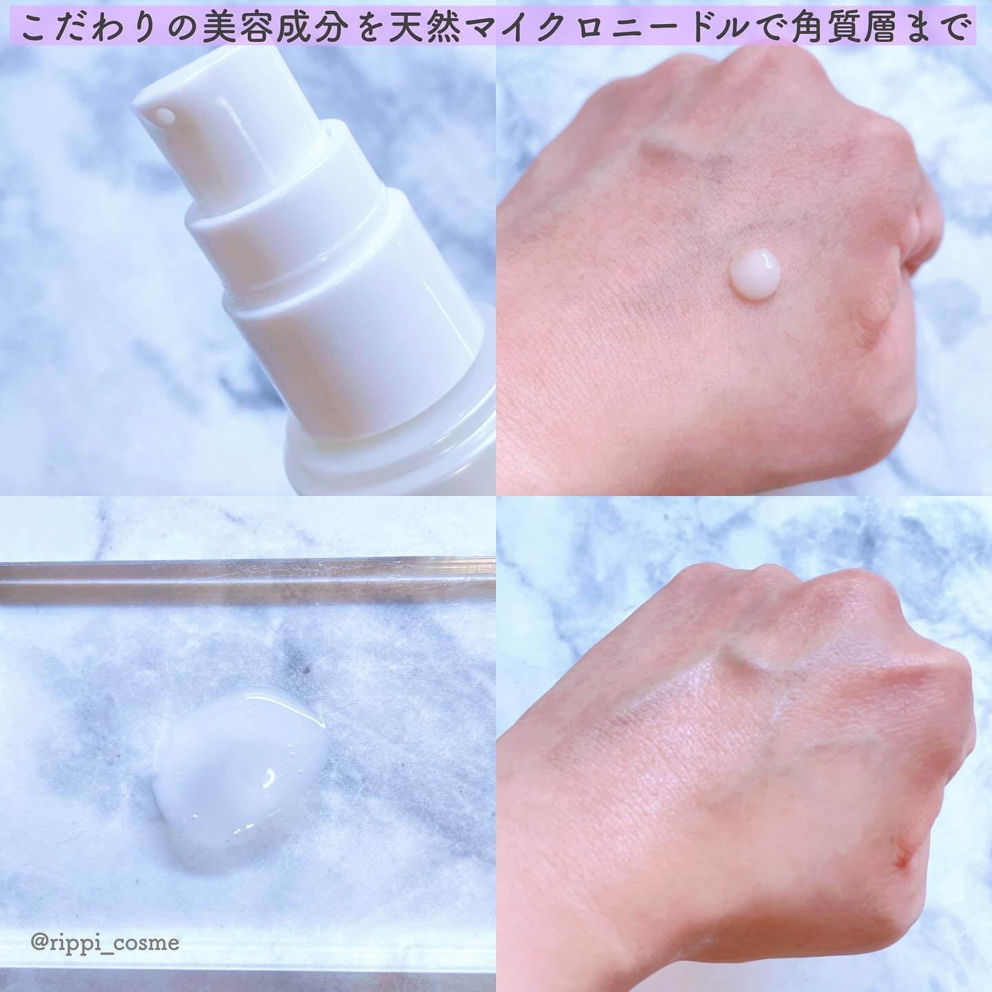 ビディ ニードルエッセンス NN/ビディ/美容液を使ったクチコミ（2枚目）