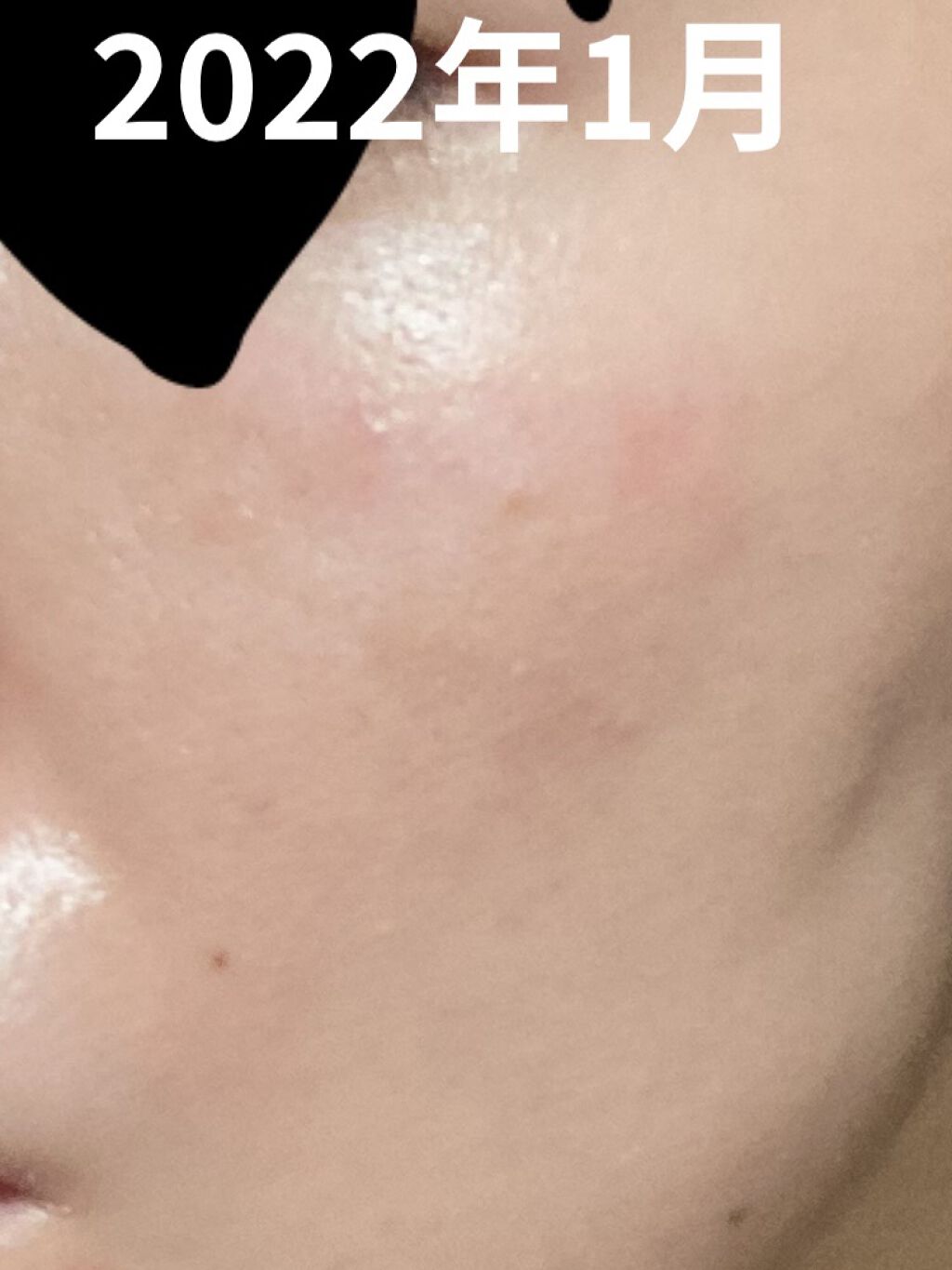 ウミツバメの巣W+アイクリーム/SNP/アイケア・アイクリームを使ったクチコミ（3枚目）