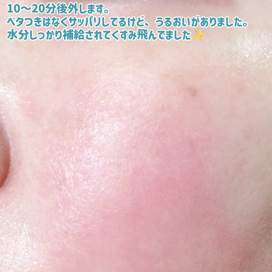 マデカッソシド エッセンシャルマスク/MEDIHEAL/シートマスク・パックを使ったクチコミ(7枚目)