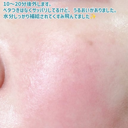 マデカッソシド エッセンシャルマスク/MEDIHEAL/シートマスク・パックを使ったクチコミ(7枚目)