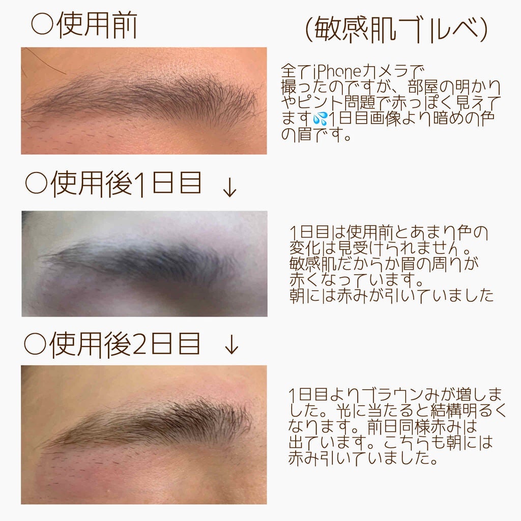 脱色クリーム 敏感肌用/エピラット/ムダ毛ケアを使ったクチコミ(4枚目)