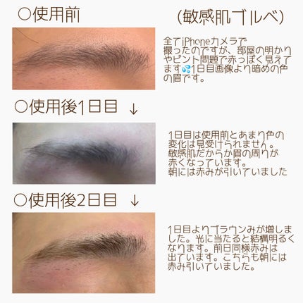 脱色クリーム 敏感肌用/エピラット/ムダ毛ケアを使ったクチコミ(4枚目)