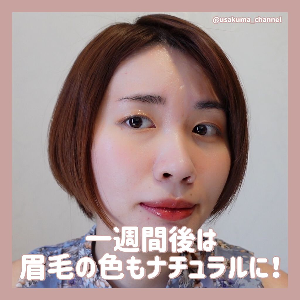 うさくまちゃん@YouTube on LIPS 「人生初の眉毛のアートメイクを渋谷デイジークリニックさんで施術し..」(7枚目)