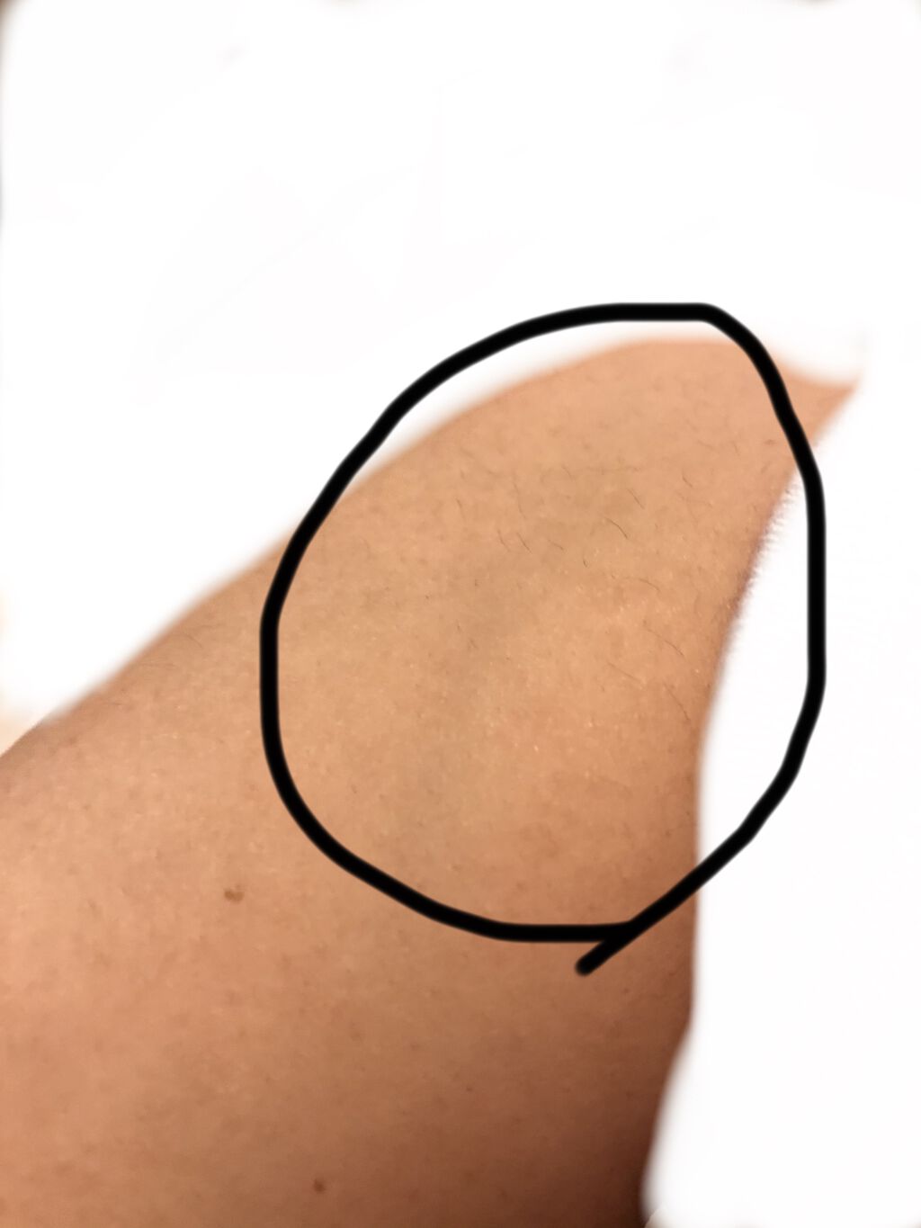 BoSidin レーザー脱毛器/BoSidin/家庭用脱毛器を使ったクチコミ（3枚目）