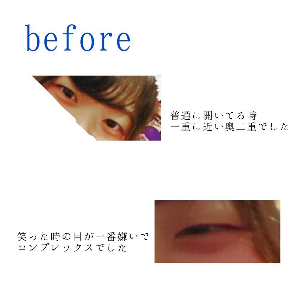 アイトーク/アイトーク/二重まぶた用アイテムを使ったクチコミ(2枚目)