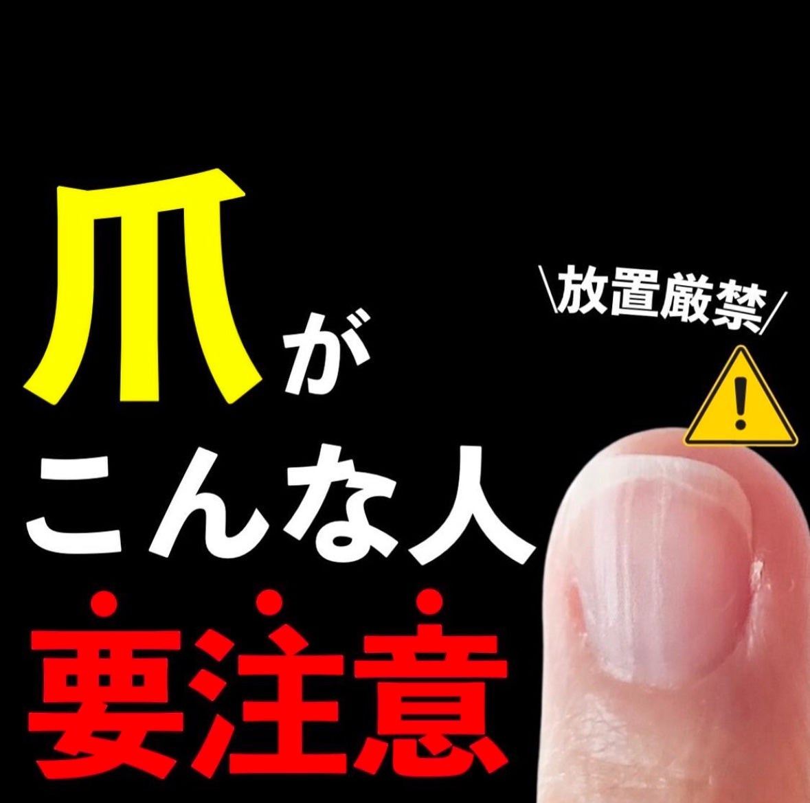 あなたの肌に合ったスキンケア💐コーくん先生 on LIPS 「【知らないとマジ危険】爪ががこんな人は毛穴一生消えない🤫..あ..」(1枚目)