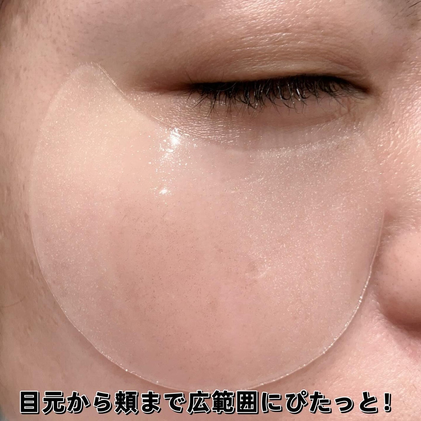 グルタチオンダークゼロトーニングパッチ/SNP/アイケア・アイクリームを使ったクチコミ(4枚目)