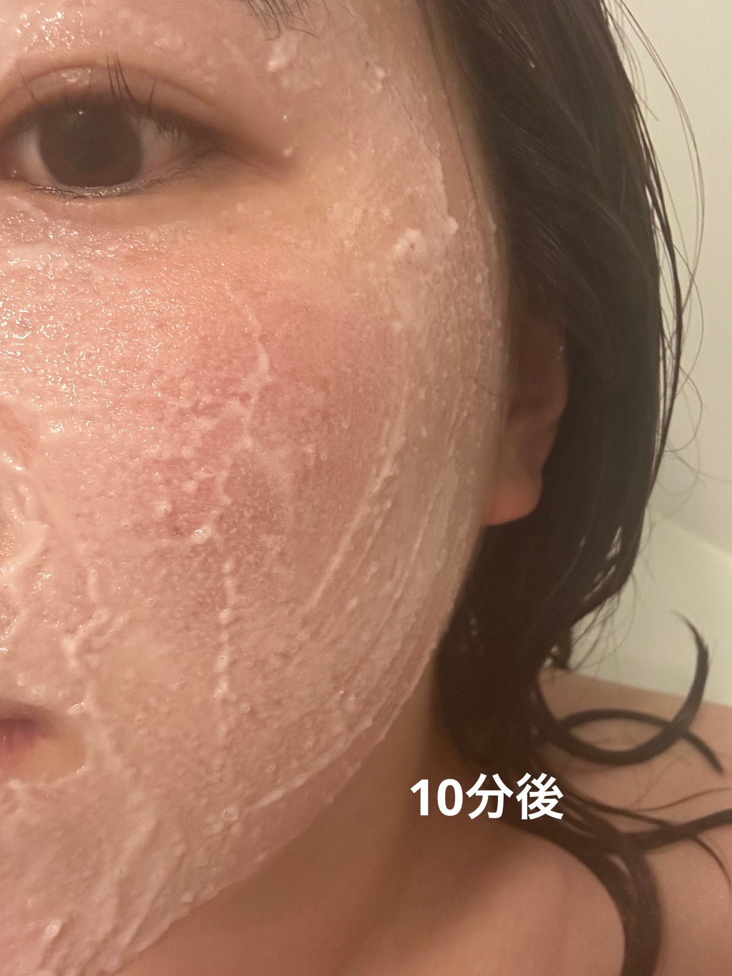 ピンクティーツリートナー/APLIN/化粧水を使ったクチコミ(5枚目)