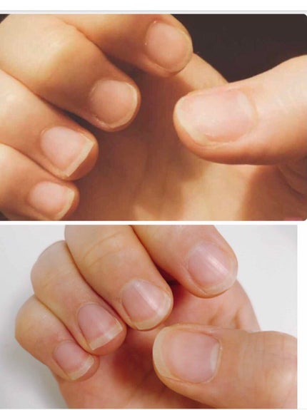 Somptueux(ソンプチュー) ネイルオイル/DAISO/ネイルオイル・トリートメントを使ったクチコミ(2枚目)