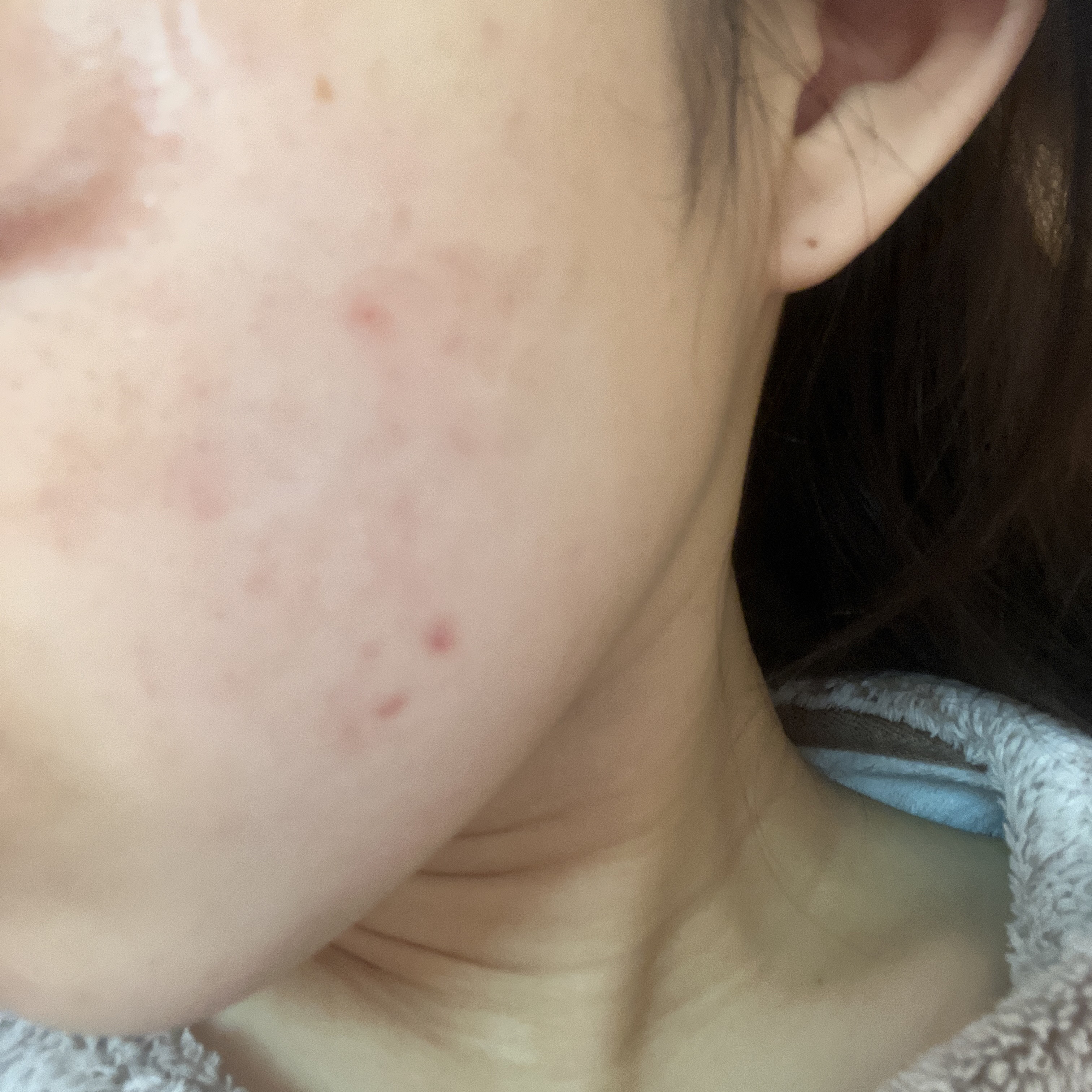 潤浸保湿 化粧水 II しっとり/キュレル/化粧水を使ったクチコミ（2枚目）