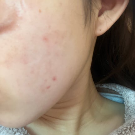 潤浸保湿 化粧水 II しっとり/キュレル/化粧水を使ったクチコミ(2枚目)