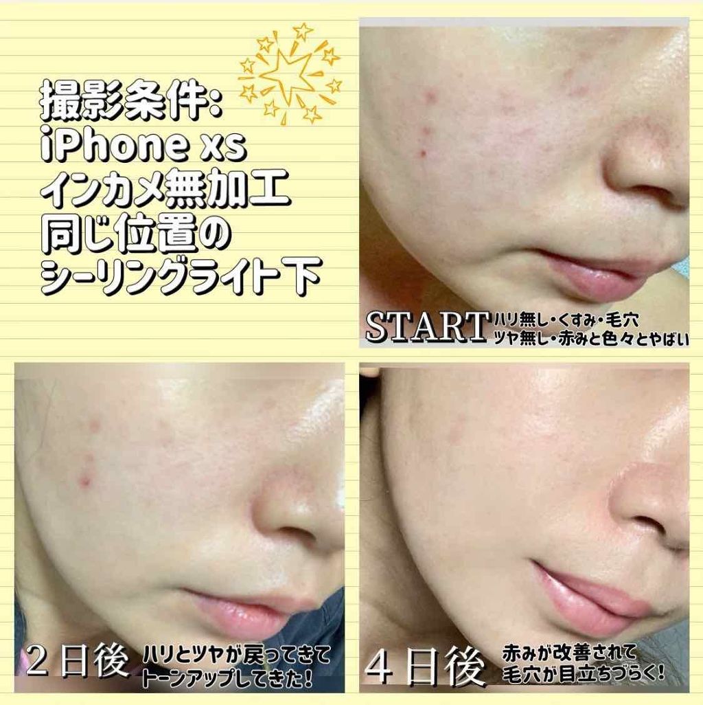 ハトムギ化粧水(ナチュリエ スキンコンディショナー R )/ナチュリエ/化粧水を使ったクチコミ(3枚目)