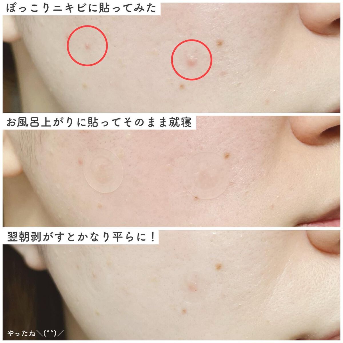 トラブルキュア/美肌ファクトリー/シートマスク・パックを使ったクチコミ(4枚目)