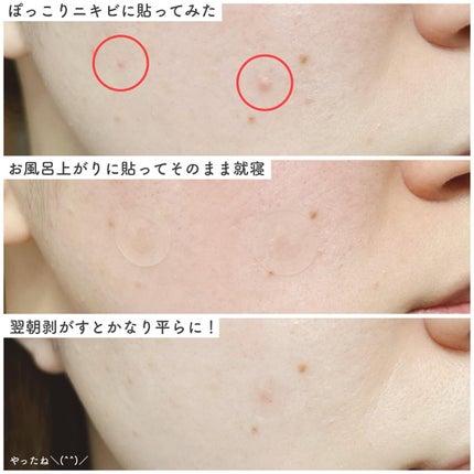 トラブルキュア/美肌ファクトリー/シートマスク・パックを使ったクチコミ(4枚目)