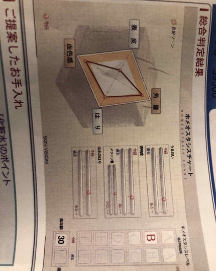 シンクロスキン ラスティング リキッドファンデーション/SHISEIDO/リキッドファンデーションを使ったクチコミ(4枚目)