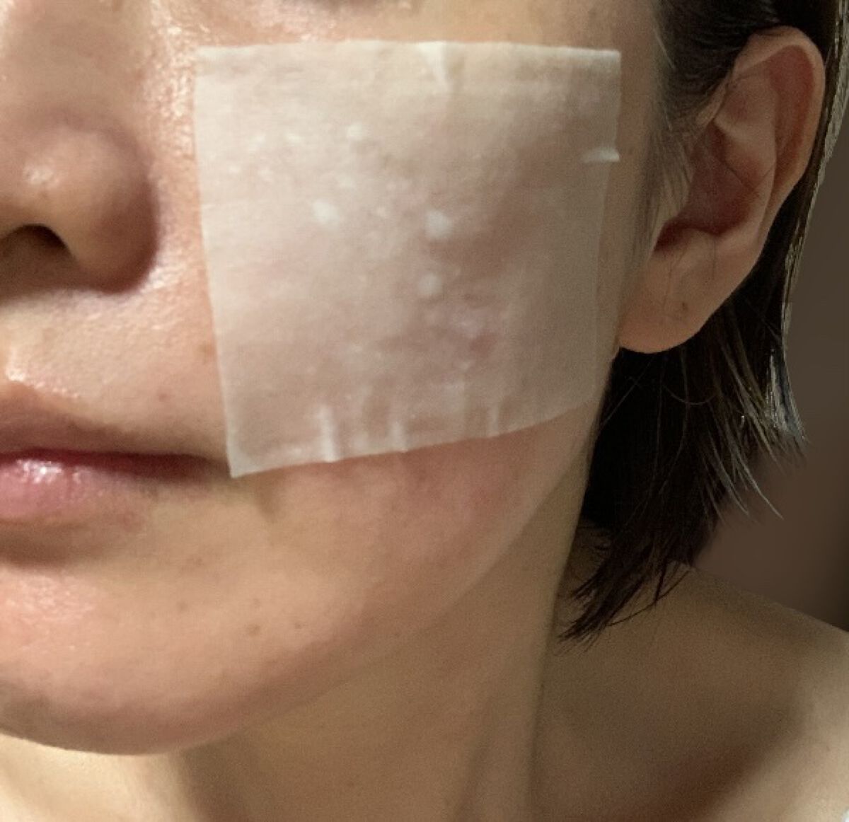 薬用プロテクトローション/アクネバリア/化粧水を使ったクチコミ（3枚目）