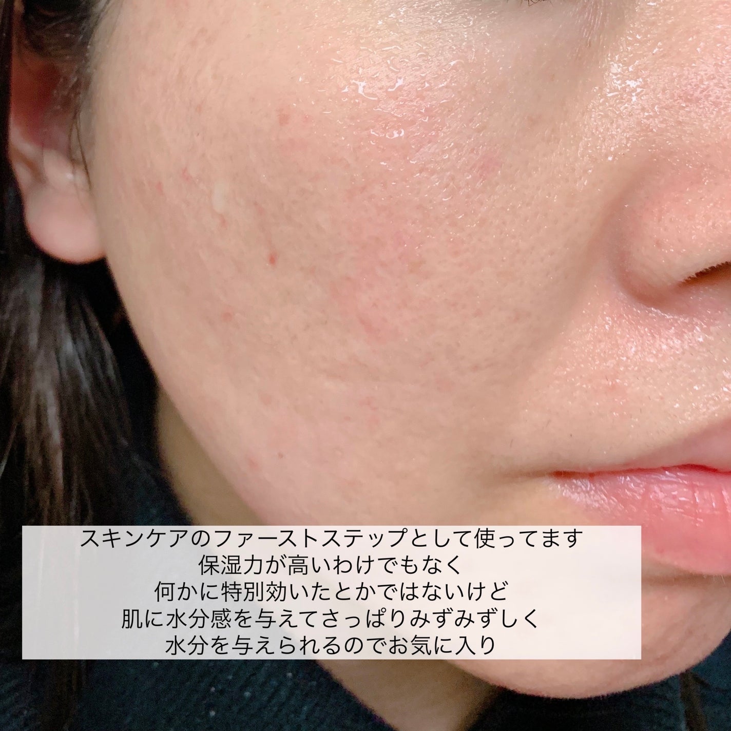 ハトムギ保湿ジェル(ナチュリエ スキンコンディショニングジェル)/ナチュリエ/美容液を使ったクチコミ(6枚目)