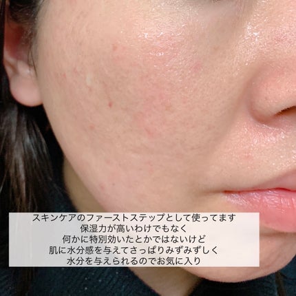 ハトムギ保湿ジェル(ナチュリエ スキンコンディショニングジェル)/ナチュリエ/美容液を使ったクチコミ(6枚目)