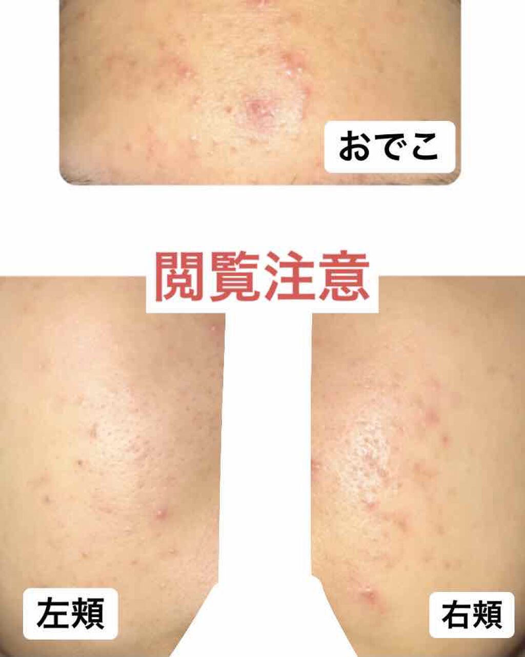 スパ・エ・メール ブラン コンフォール/Prédia/化粧水を使ったクチコミ（3枚目）