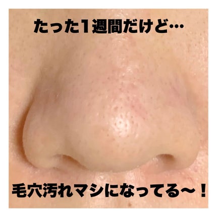 デュオ ザ クレンジングバーム ブラック/DUO/クレンジングバームを使ったクチコミ(5枚目)