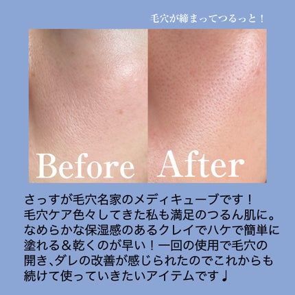 ゼロ毛穴クレイパック/MEDICUBE/洗い流すパック・マスクを使ったクチコミ(4枚目)