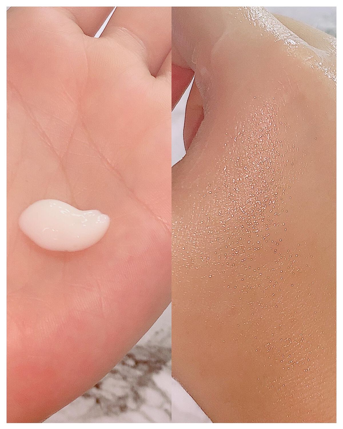 シカレチA エッセンス0.1/VT/美容液を使ったクチコミ（2枚目）