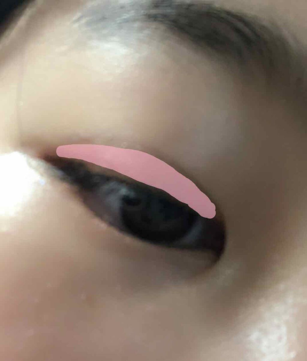 アイビューティー フィクサー WP/アストレア ヴィルゴ/二重まぶた用アイテムを使ったクチコミ（3枚目）