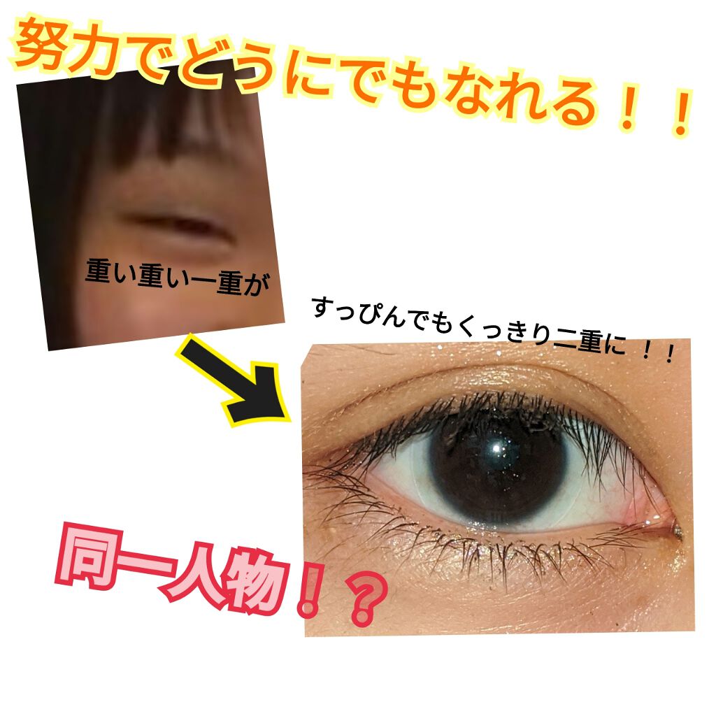 ニベアクリーム ニベアを使った口コミ 久しぶりの投稿です 私は生まれつきかな By Ma Lips