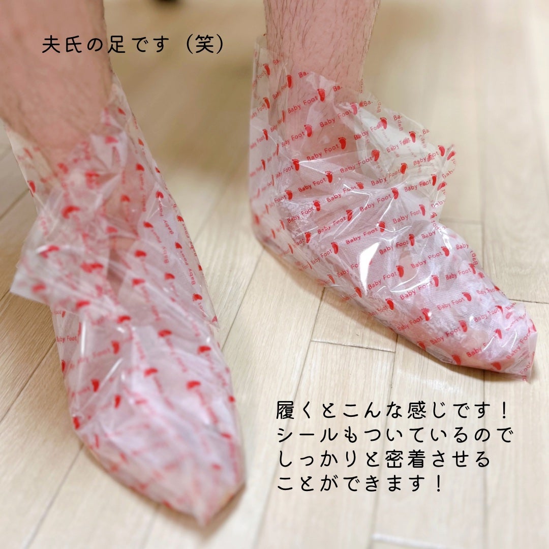 ベビーフット 重曹殺菌消毒洗浄剤/ベビーフット/レッグ・フットケアを使ったクチコミ(6枚目)