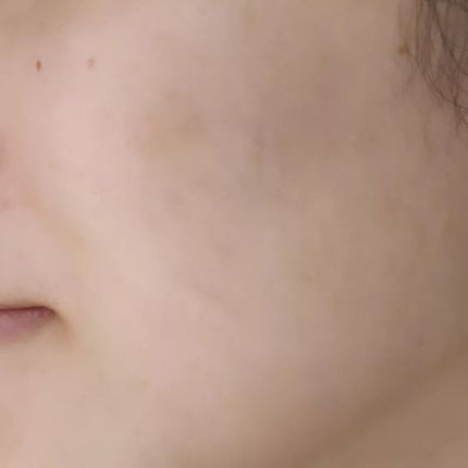 スキンケアオイル/Arbre/フェイスオイルを使ったクチコミ(5枚目)