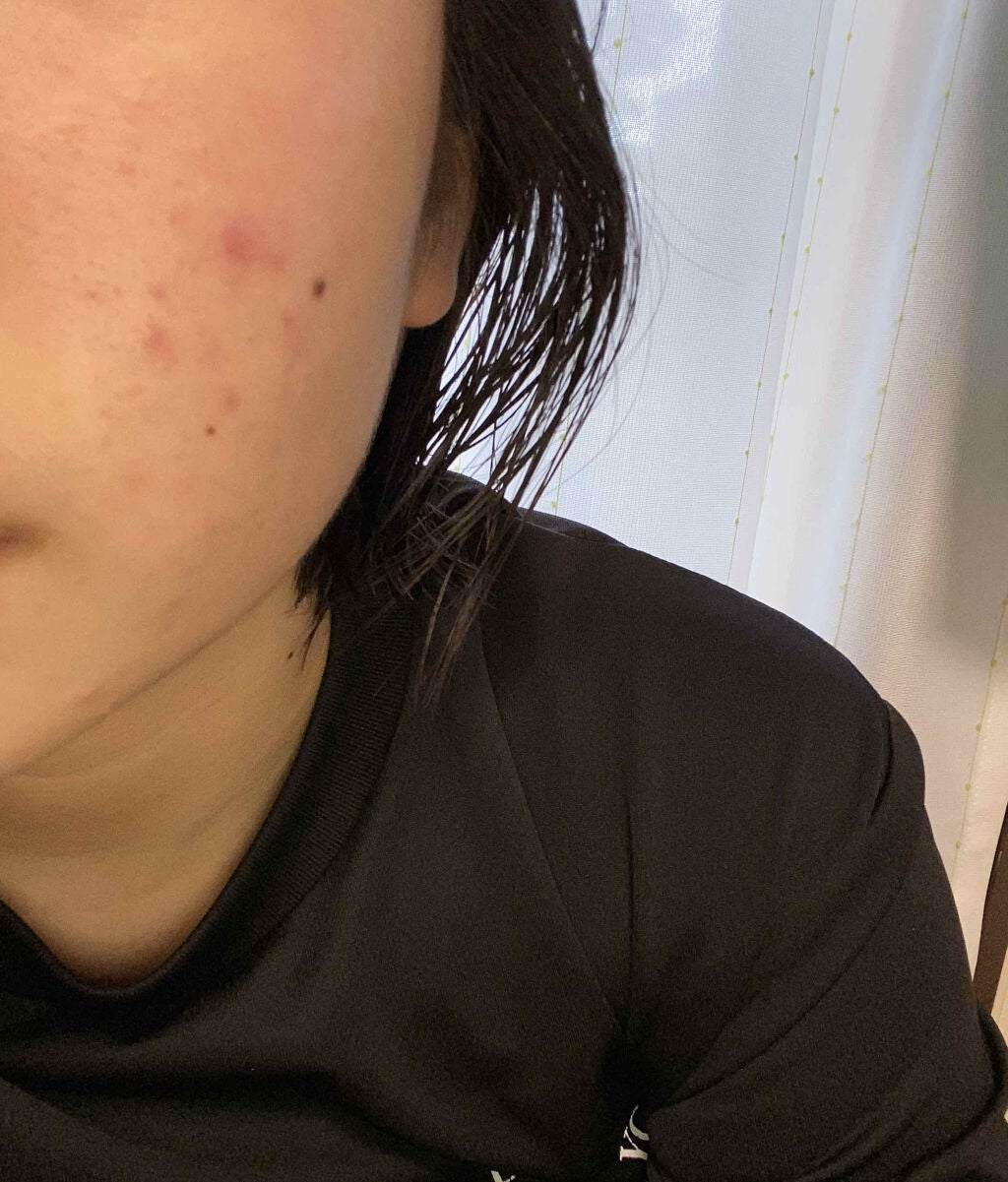 ティーツリーウォーター/ラッシュ/ミスト状化粧水を使ったクチコミ(2枚目)