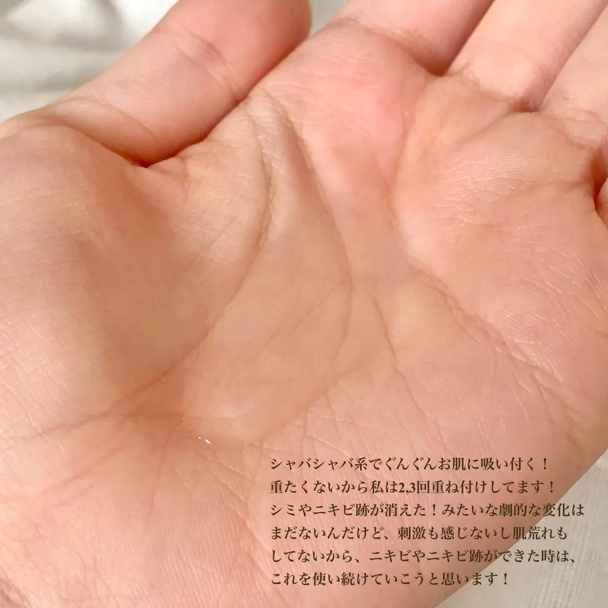 TXトーニングトナー/VT/化粧水を使ったクチコミ（3枚目）