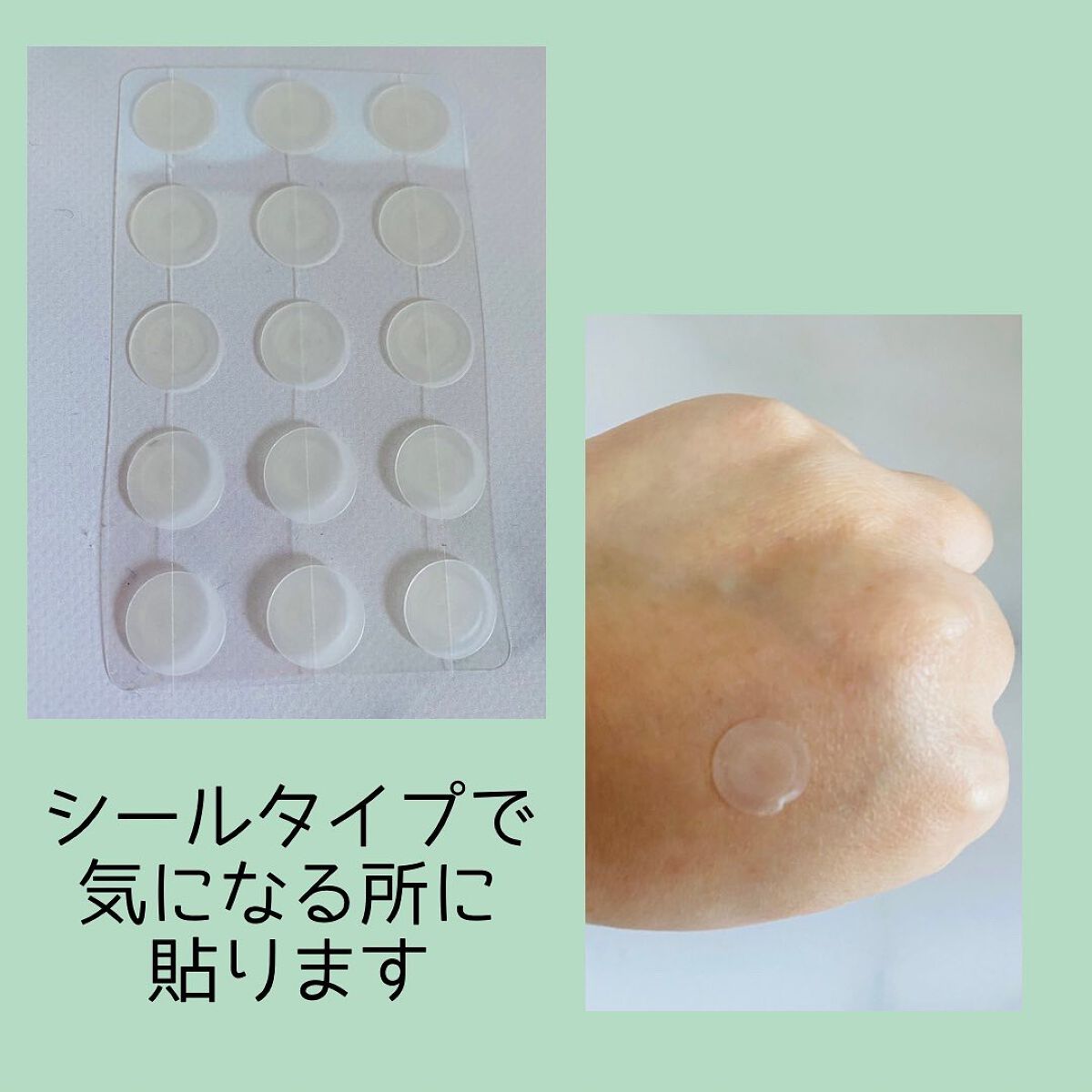 プロCICA クリアスポットパッチ/VT/その他スキンケアを使ったクチコミ(2枚目)