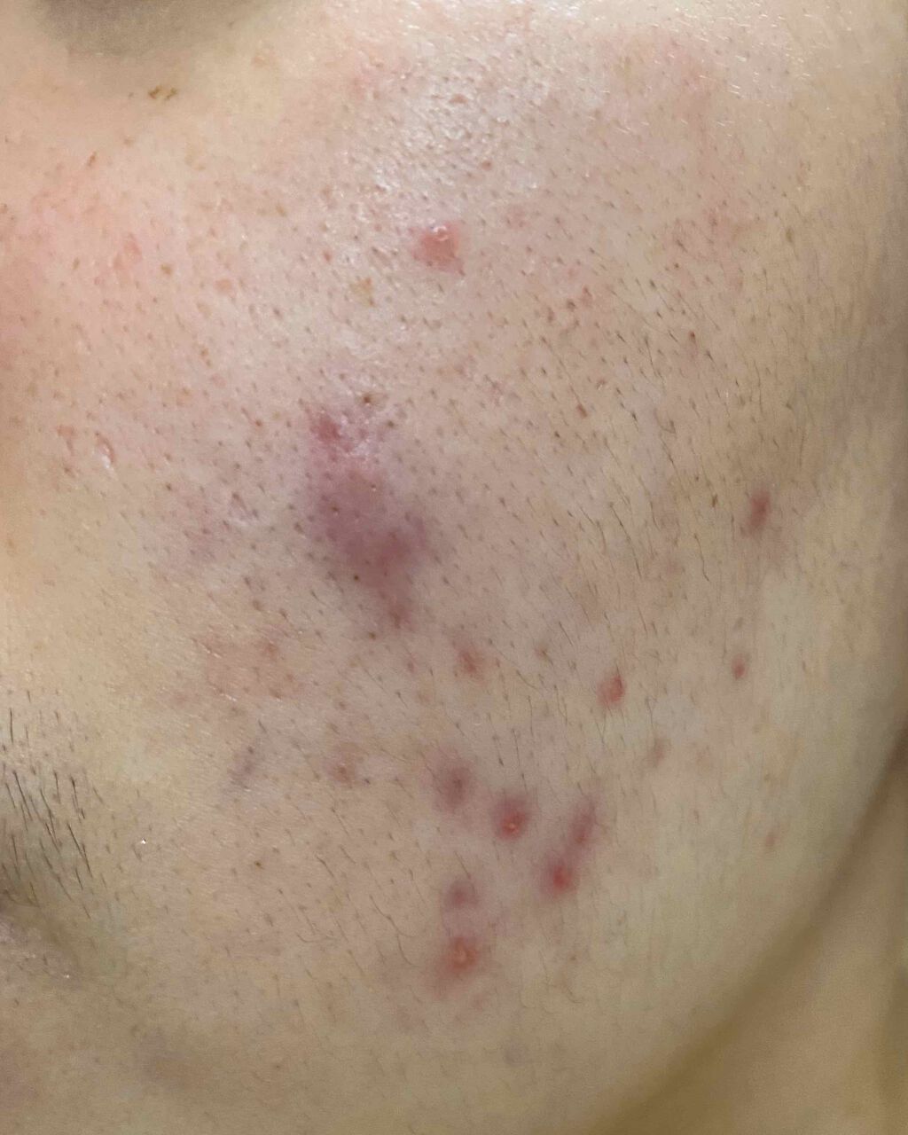 化粧水 NA/なめらか本舗/化粧水を使ったクチコミ（2枚目）