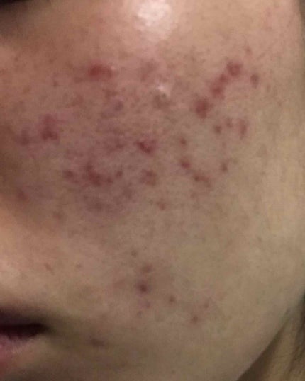 を使ったクチコミ(1枚目)