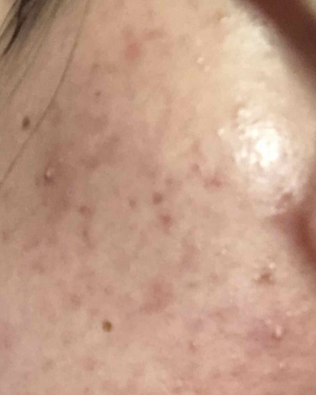 オバジX ブーストムースウォッシュ/オバジ/泡洗顔を使ったクチコミ(1枚目)