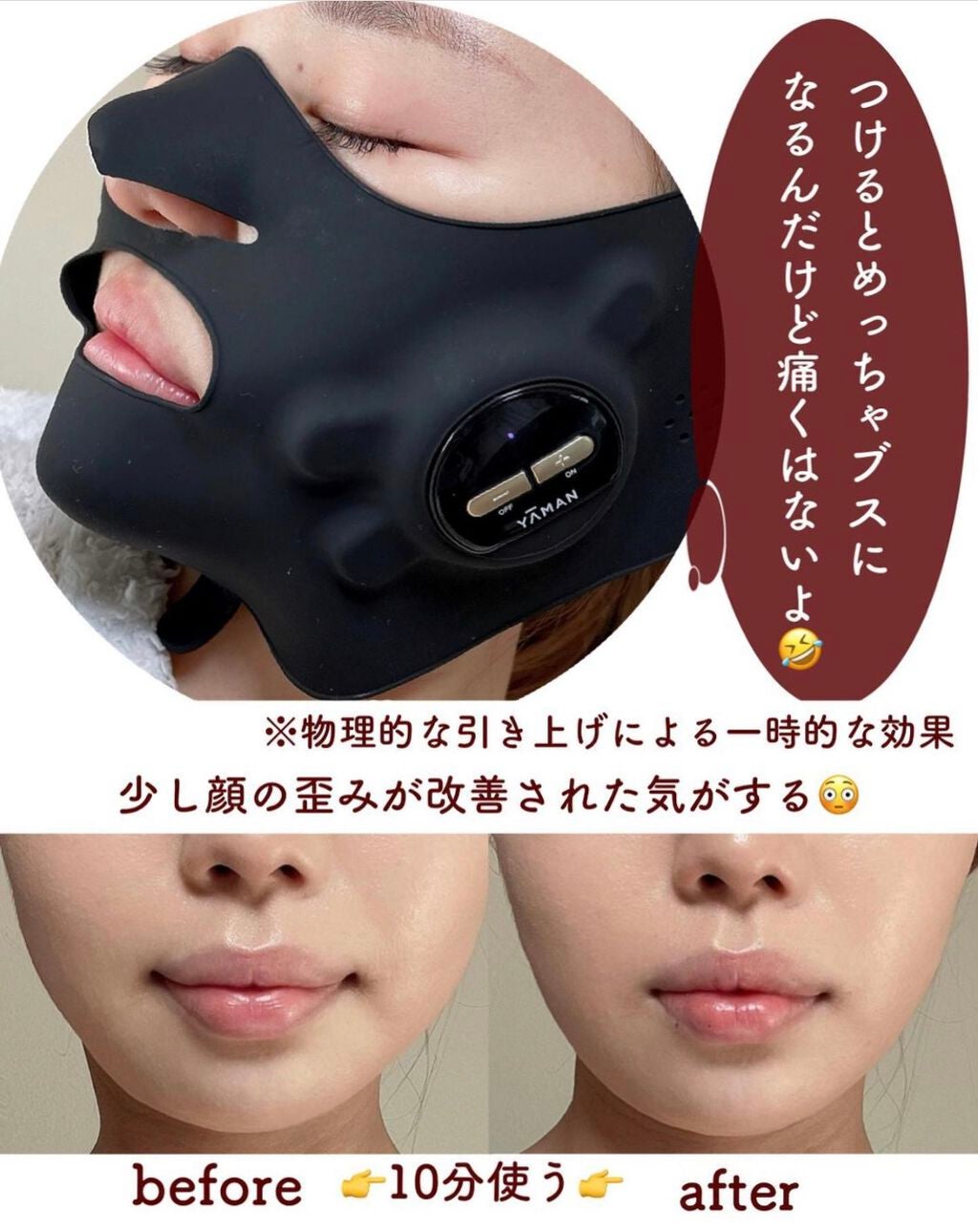 メディリフト /YA-MAN TOKYO JAPAN/美顔器・マッサージを使ったクチコミ(9枚目)