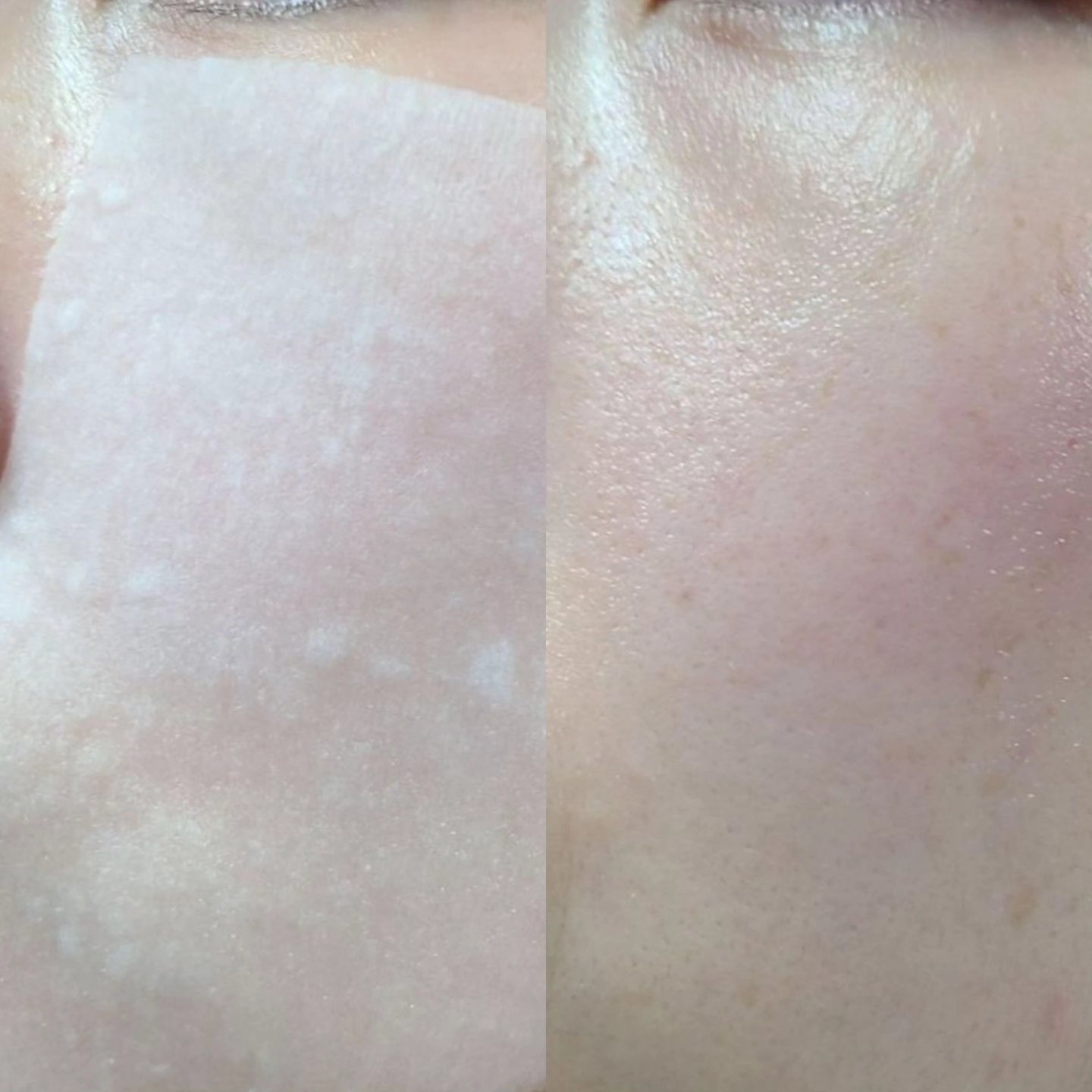 ピンクアロエビタトナー/APRILSKIN/化粧水を使ったクチコミ（3枚目）