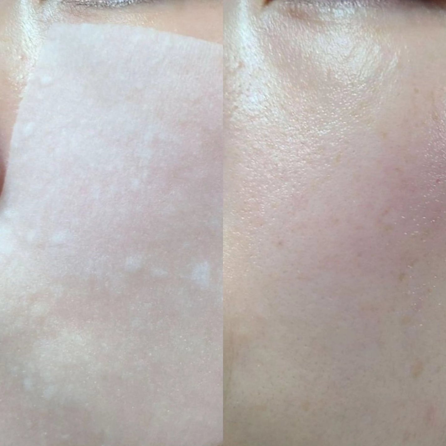 ピンクアロエビタトナー/APRILSKIN/化粧水を使ったクチコミ(3枚目)