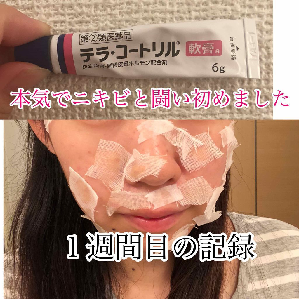 パーフェクトホイップn/SENKA（専科）/洗顔フォームを使ったクチコミ（1枚目）