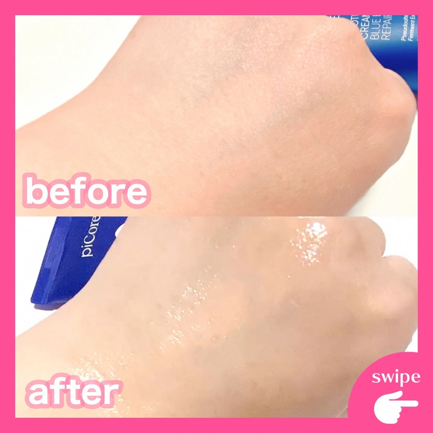 ディファレンシー スージングクリーム/piCore/フェイスクリームを使ったクチコミ(5枚目)