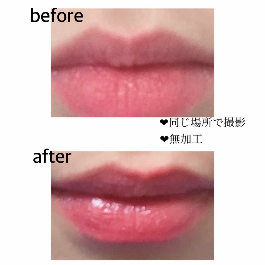 リップフォンデュ/メンソレータム/リップバームを使ったクチコミ（2枚目）